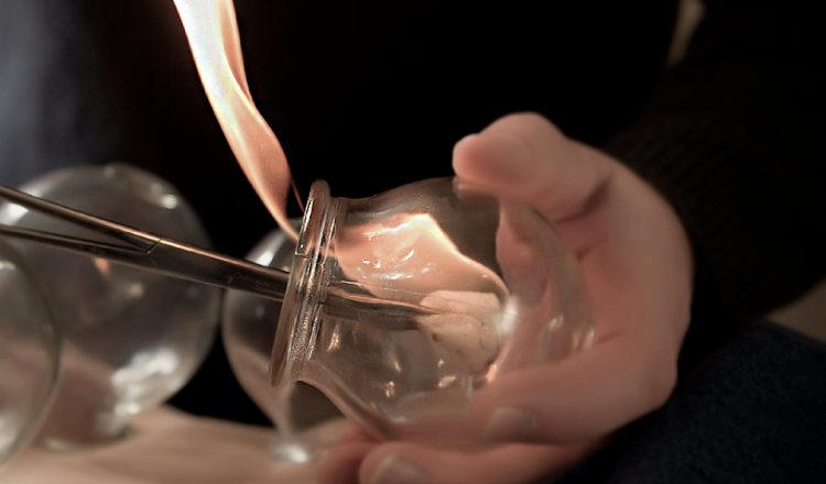 van pham mtc ventouses